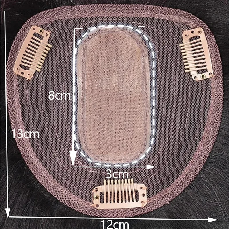 Topo De Cabeça (Cabelo Humano) - Para Alopecia, Falhas, Cabelos Ralos e com Queda